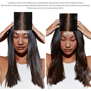 Kerastase Symbiose Intense Revitalizing Mask (Beschadigd haar met neiging tot roos) 200 ml